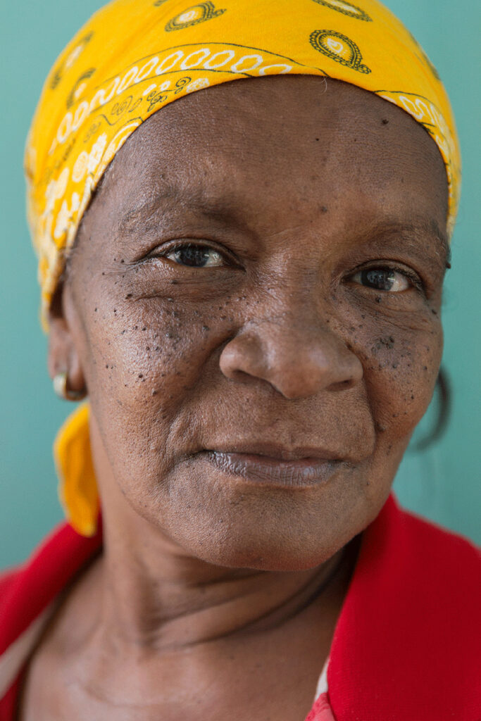 Aging face documented by Oded Wagenstein.